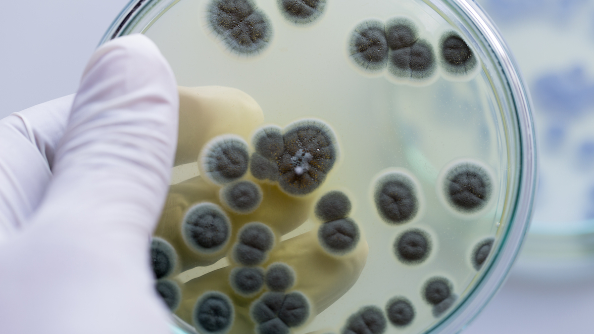 infezione della pelle fungina vulva infezione della pelle fungina vulva