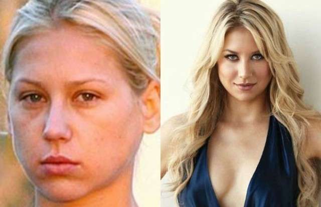 Anna Kournikova