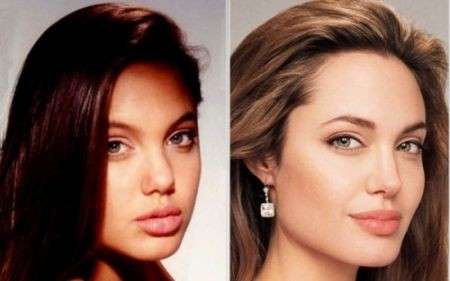 Angelina Jolie prima e dopo