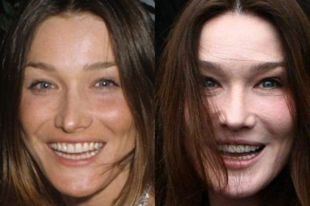 Carla Bruni prima e dopo