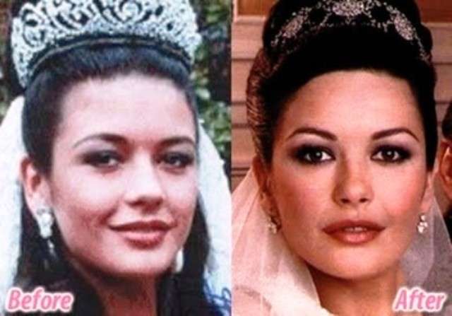 Catherine Zeta Jones prima e dopo