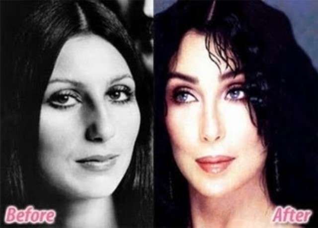 Cher prima e dopo