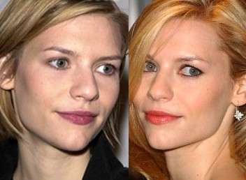 Claire Danes prima e dopo