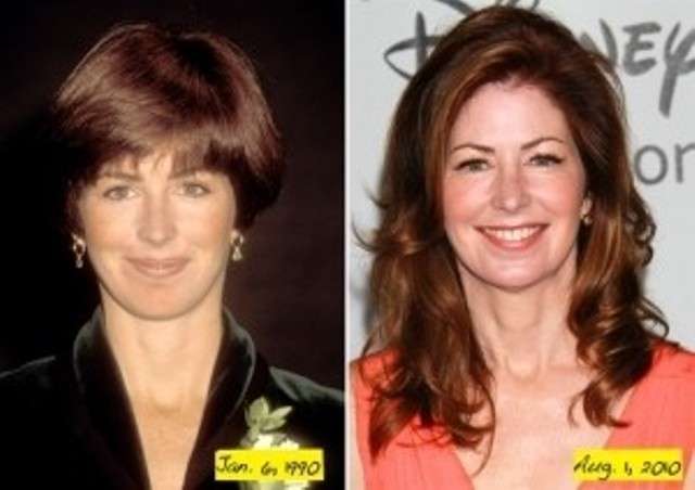 Dana Delany prima e dopo