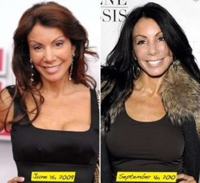 Danielle Staub prima e dopo