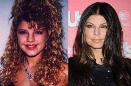 Fergie prima e dopo