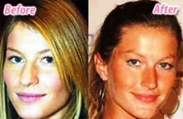 Gisele Bundchen prima e dopo