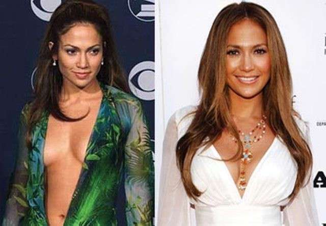 Jennifer Lopez prima e dopo
