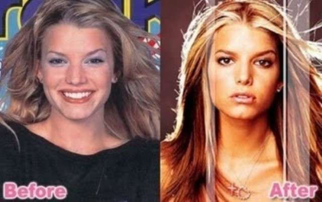 Jessica Simpson prima e dopo