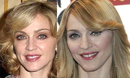 Madonna prima e dopo