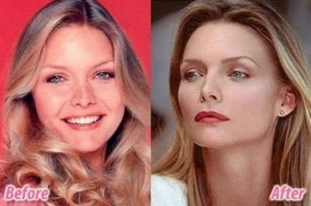 Michelle Pfeiffer prima e dopo