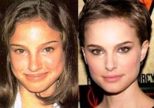 Natalie Portman prima e dopo