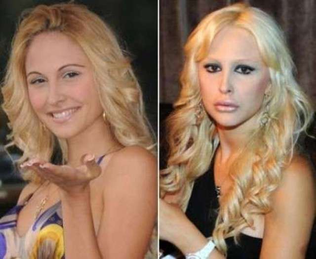 Noemi Letizia prima e dopo