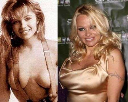 Pamela Anderson prima e dopo