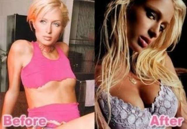 Paris Hilton prima e dopo