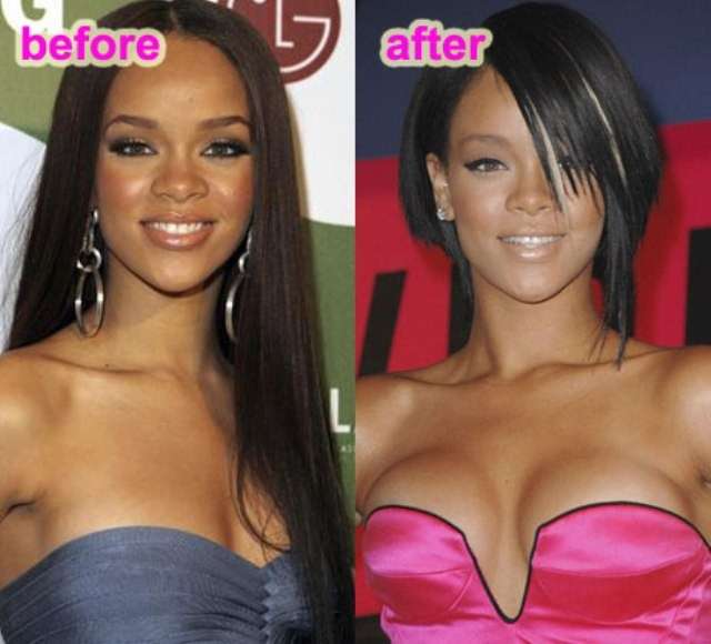 Rihanna prima e dopo