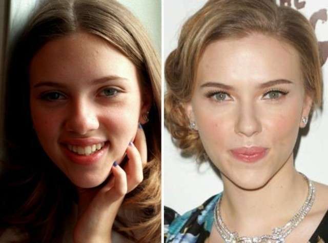Scarlett Johansson prima e dopo