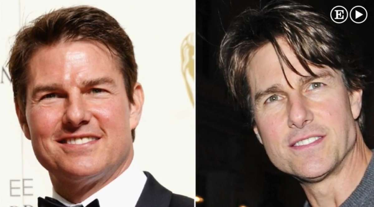 Tom Cruise, dopo e prima il botox