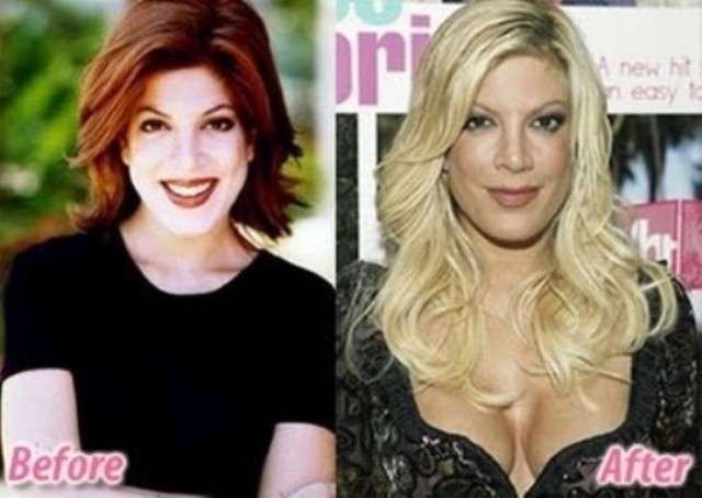 Tori Spelling prima e dopo