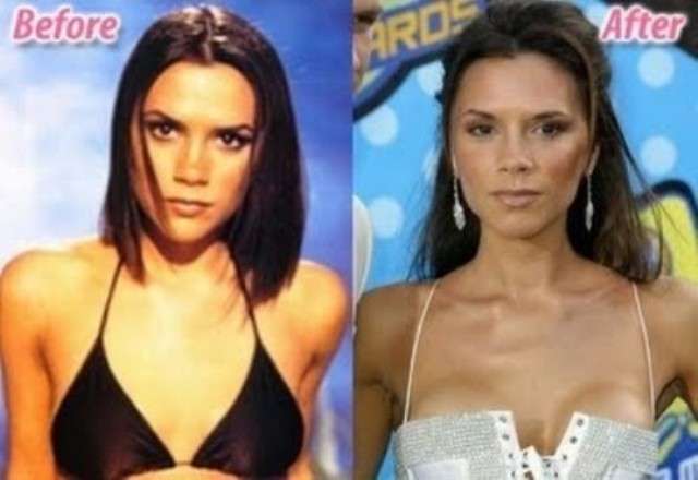 Victoria Beckham prima e dopo