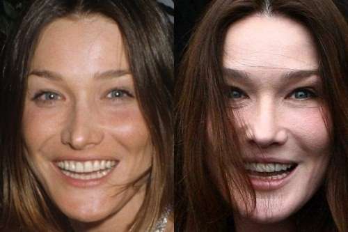 Carla Bruni