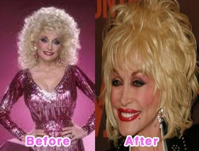 Dolly Parton