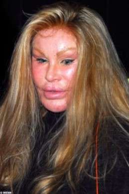 Jocelyn Wildenstein