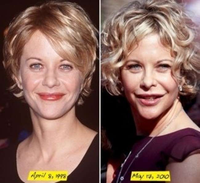 Meg Ryan