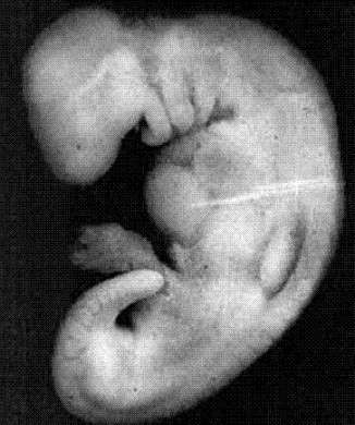 Lunghezza del feto nella fase iniziale
