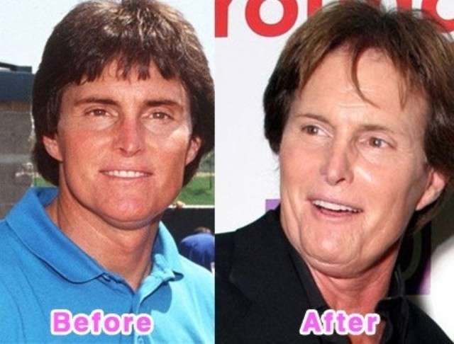 Bruce Jenner