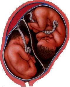 Gravidanza gemellare: bimbi nell'utero