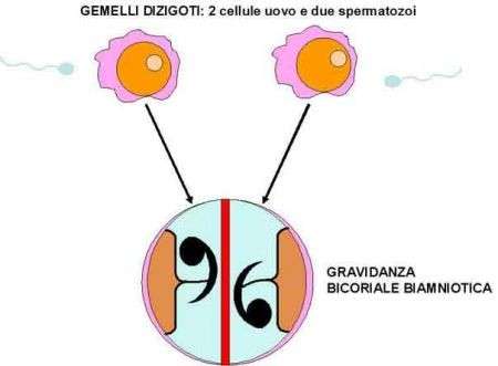 Gravidanza gemellare: gemelli eterozigoti