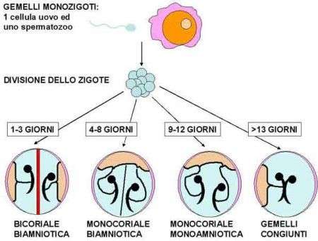 Gravidanza gemellare: gemelli omozigoti