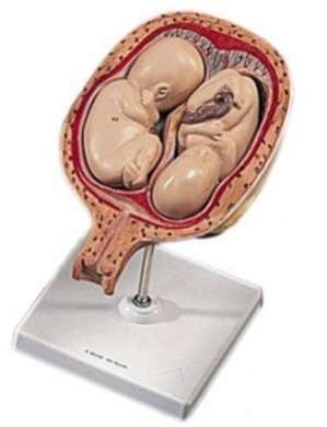 Gravidanza gemellare: ricostruzione dell'utero della mamma