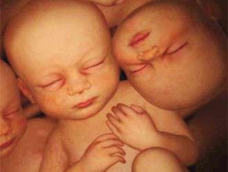 Gravidanza gemellare: tre gemelli nell'utero