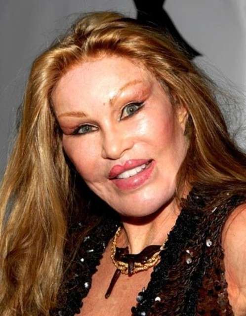 Jocelyn Wildenstein