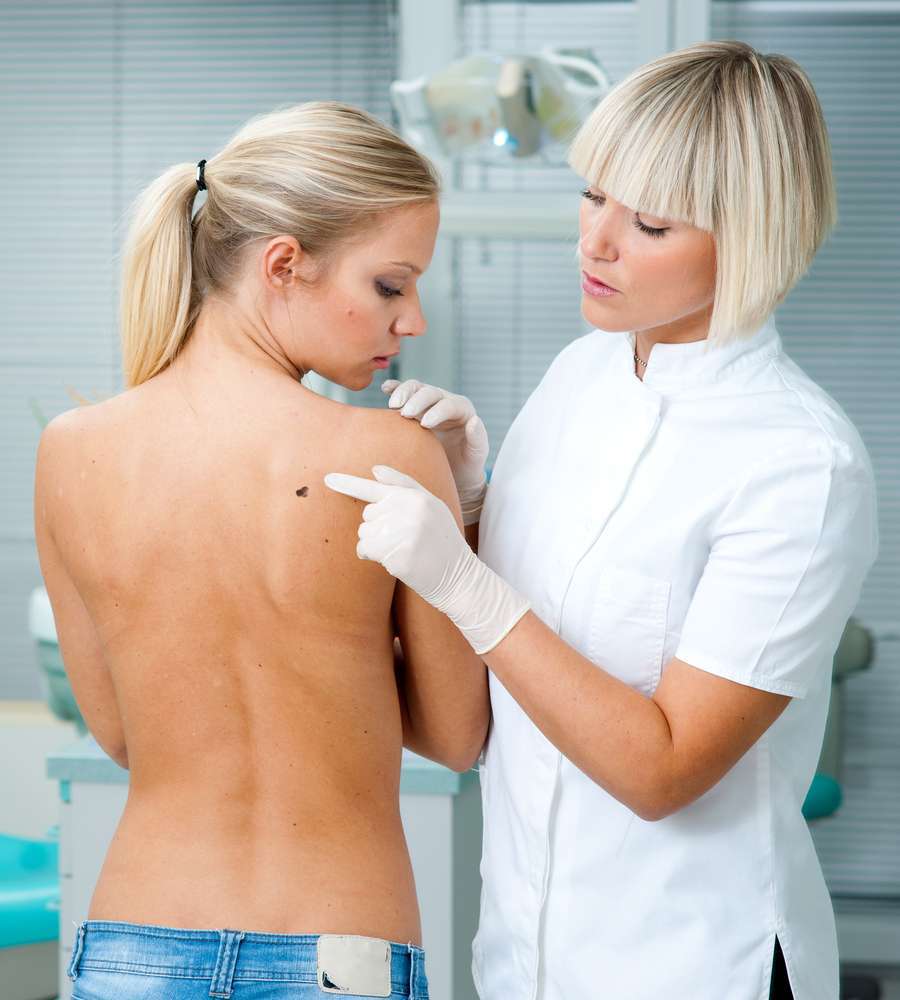 La prevenzione del melanoma