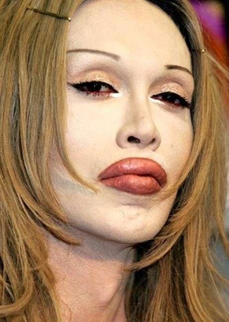 Pete Burns