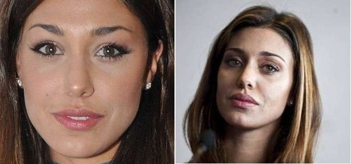 Le labbra di Belen Rodriguez prima e dopo
