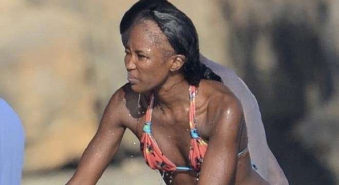 Naomi Campbell calvizie