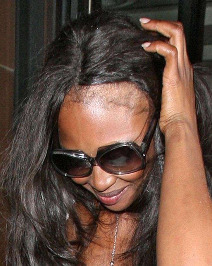 Naomi Campbell senza capelli