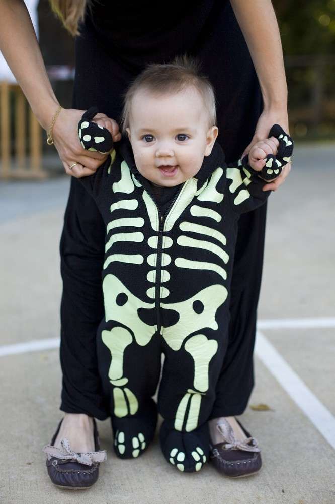 Bambino scheletrico