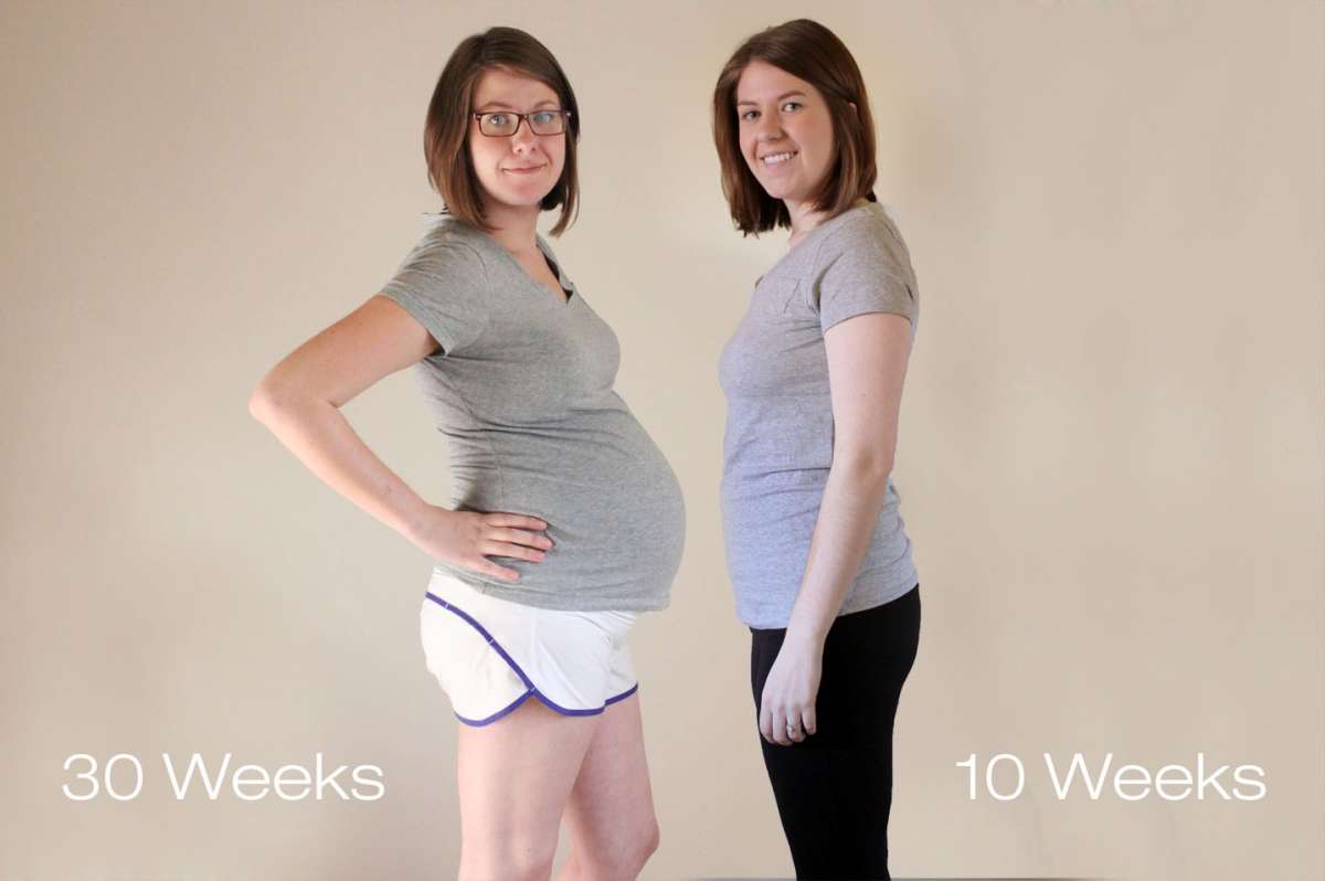 Gravidanza 10ma e 30ma settimana