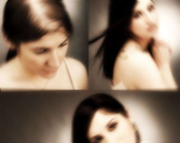 Alopecia