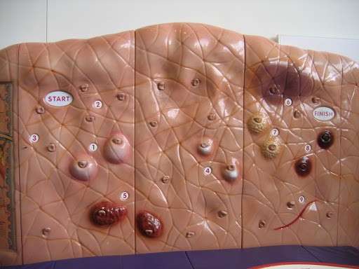 Plastico della pelle