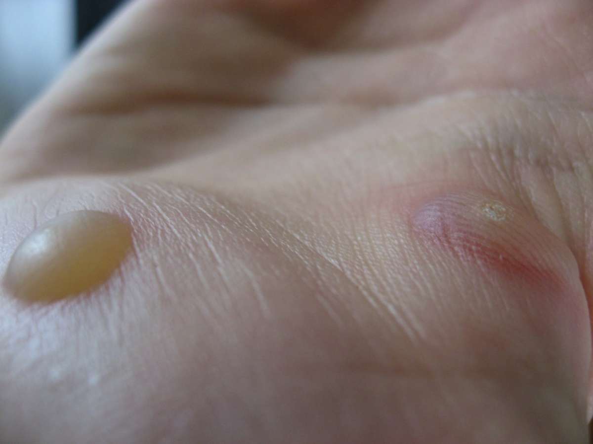 Porro sul palmo della mano
