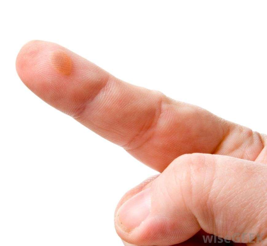 Porro sull'indice