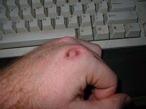 Porro sulla nocca