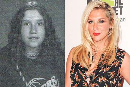 Kesha