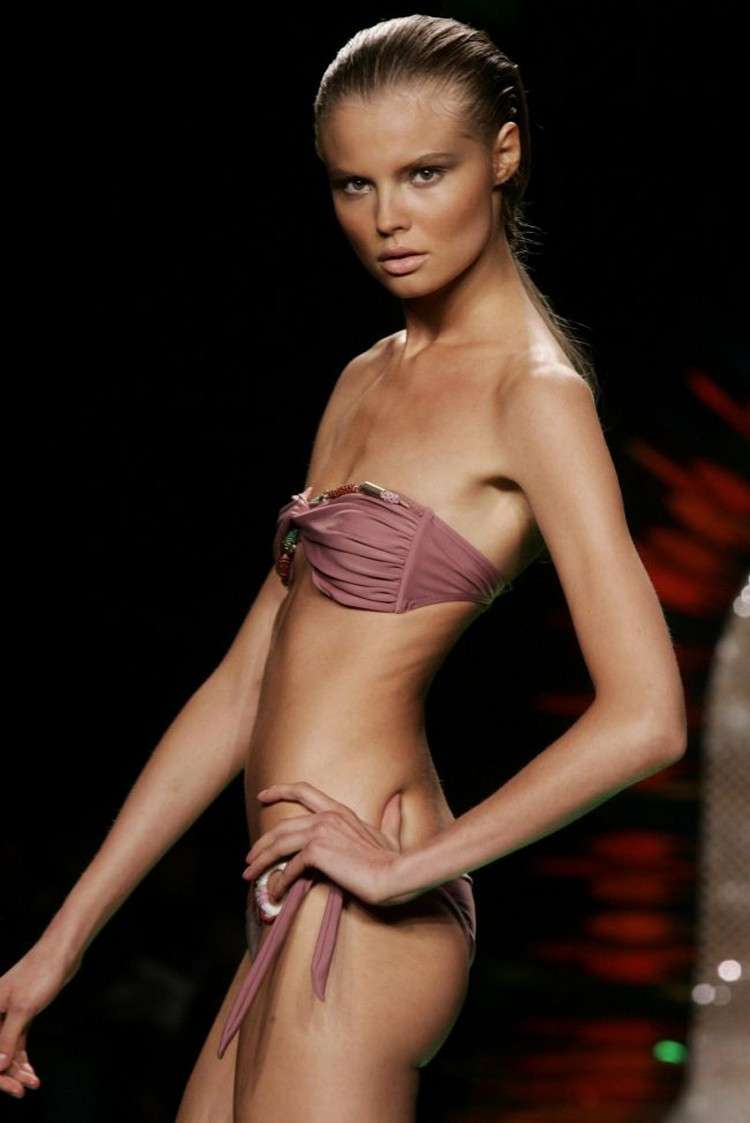 Modella anoressica con fisico ossuto